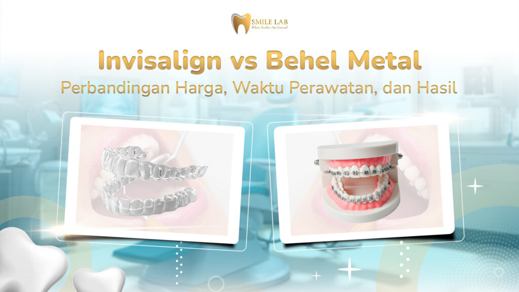 Invisalign vs Behel Metal: Perbandingan Harga, Waktu Perawatan, dan Hasil