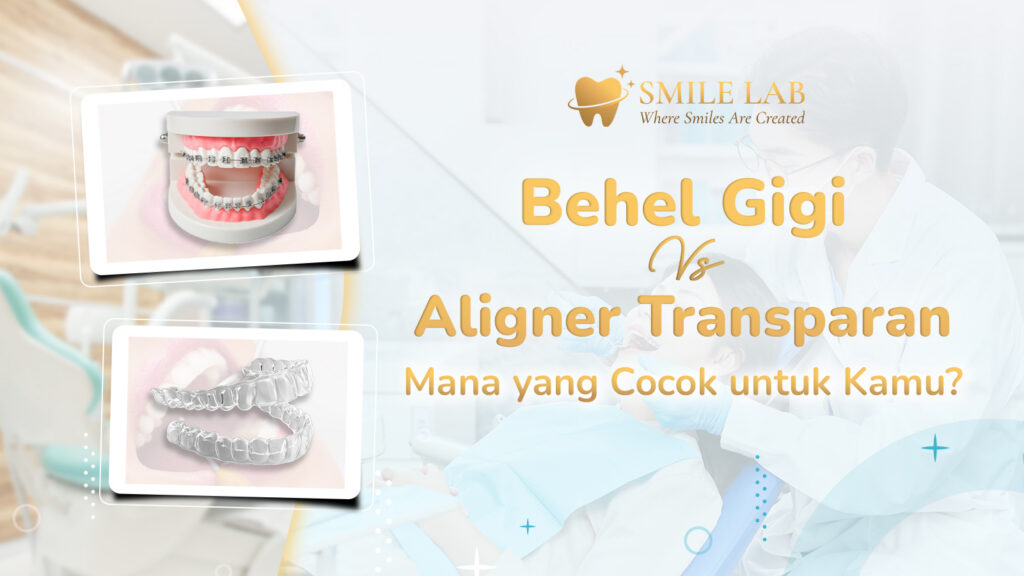 Behel Gigi vs Aligner Transparan: Mana yang Cocok untuk Kamu?
