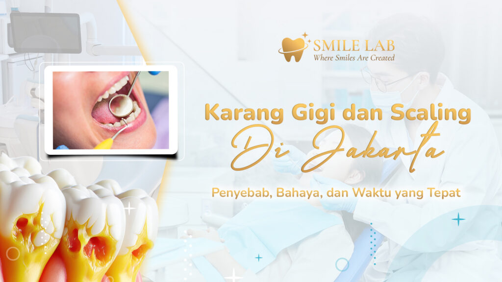 Karang Gigi dan Scaling di Jakarta: Penyebab, Bahaya, dan Waktu yang Tepat
