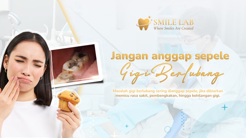 Jangan anggap sepele gigi berlubang!