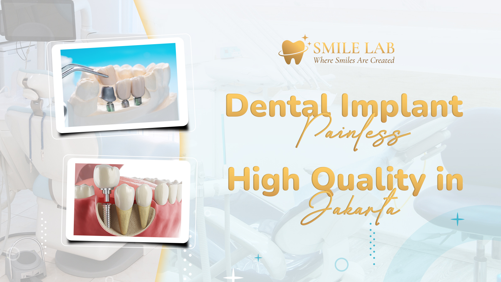 Dental Implant Painless & High Quality in Jakarta