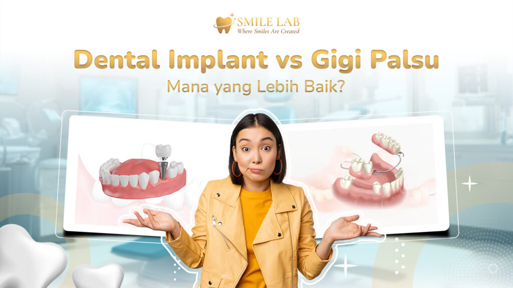 Dental Implant vs Gigi Palsu: Mana yang Lebih Baik?