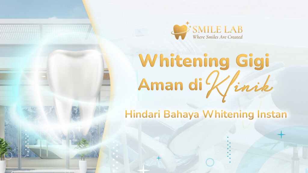 Whitening Gigi Aman di Klinik: Hindari Bahaya Whitening Instan