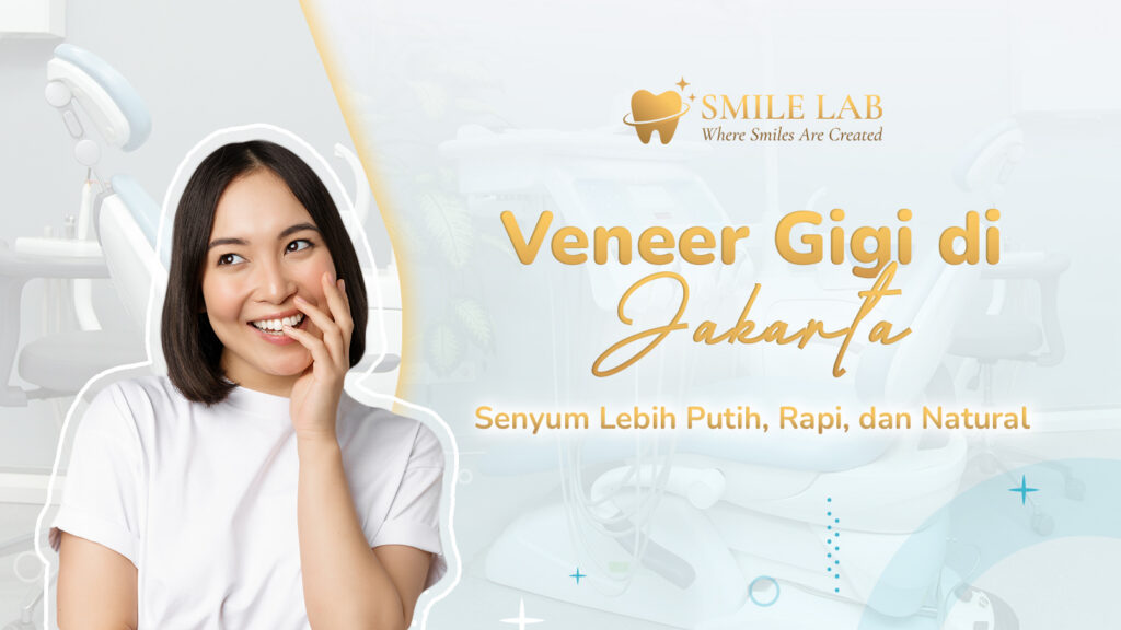 Veneer Gigi di Jakarta: Senyum Lebih Putih, Rapi, dan Natural