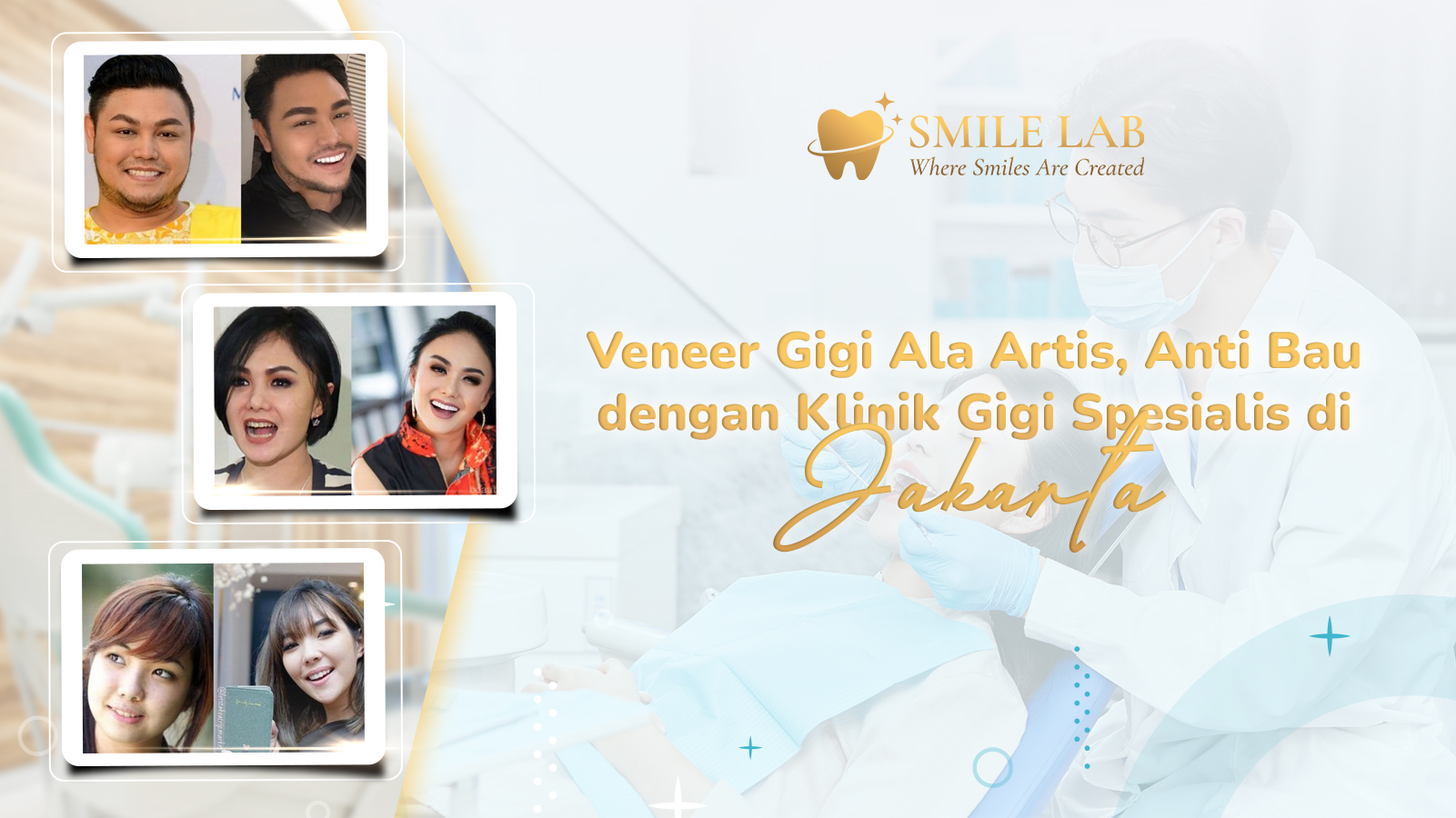 Veneer Gigi Ala Artis, Anti Bau dengan Klinik Gigi Spesialis di Jakarta